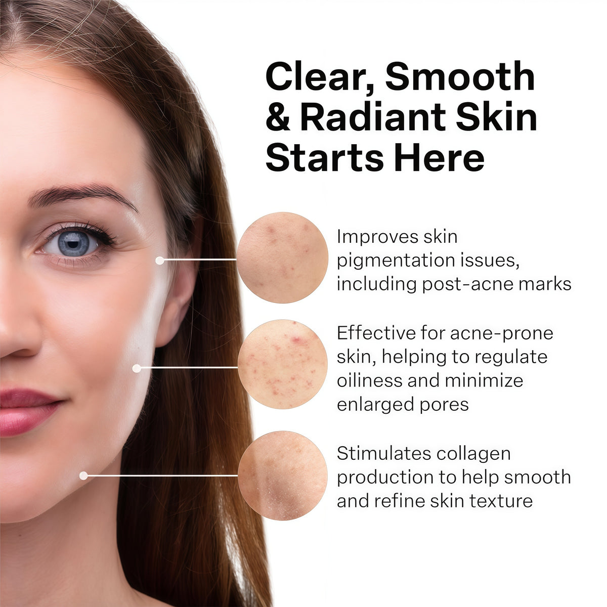 A313 Retinol Cream | Vitamin A Pommade (Ointment), 50g